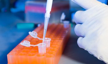 Estudo Molecular da Mutação do Gene BRAF